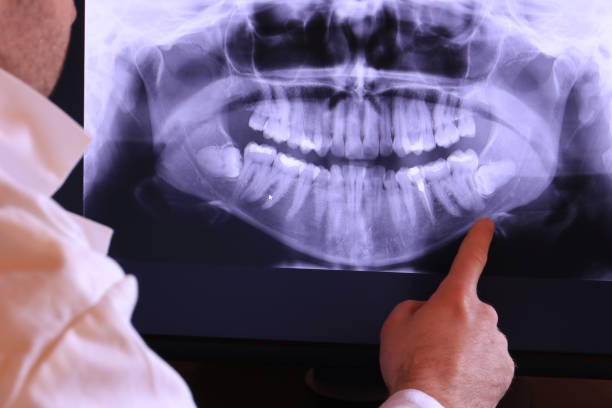 Best Mobile Emergency Dentist in Buda, TX