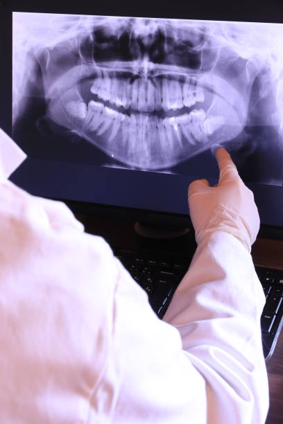Best Emergency Dental Extractions in Buda, TX
