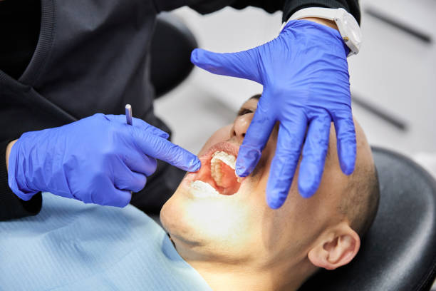 Best Emergency Dentist for Knocked-Out Tooth in Buda, TX